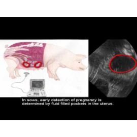 Ultrasounding for Pregnancy